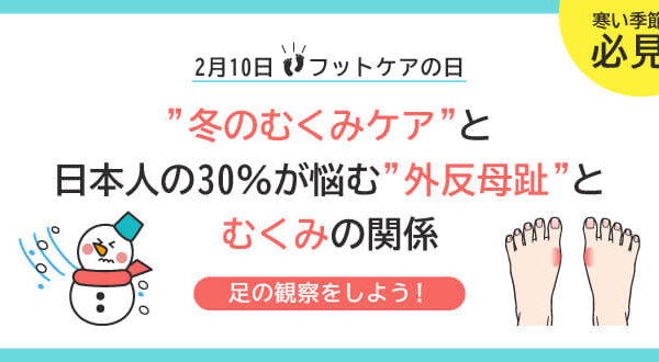 2月10日はフットケアの日！「冬のむくみケア」と日本人の30％が悩む「外反母趾」の関係